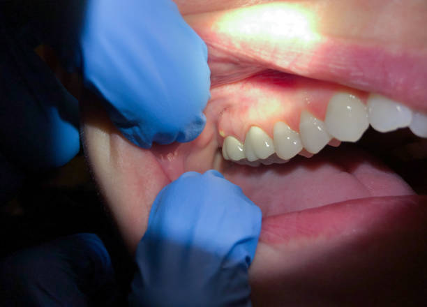 Best Emergency TMJ Treatment in Parkville, MD